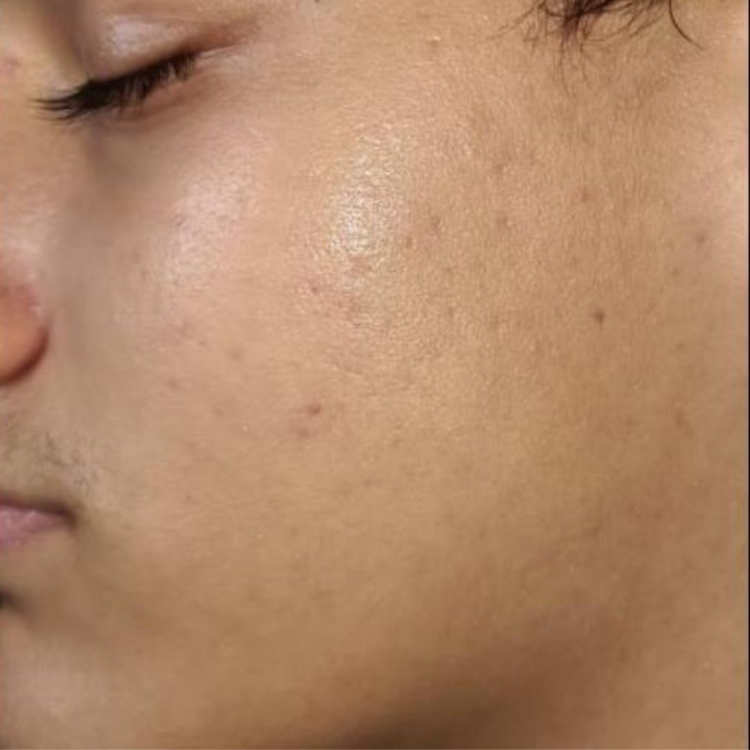 imgi_56_avant-apres-DR-PLATON