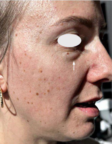 ba7